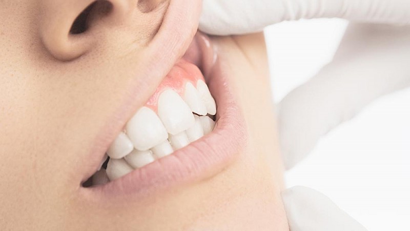 علائم همراه با درد لثه | بهترین دندانپزشک اصفهان