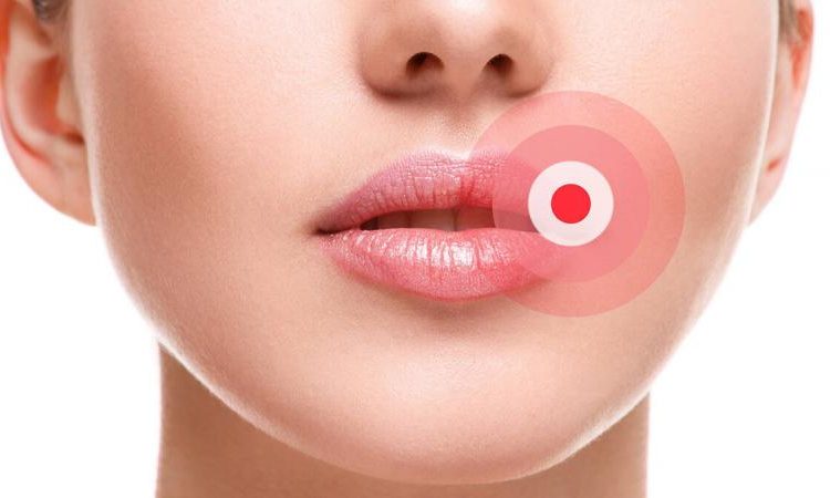 Les principales causes d'engourdissement des lèvres | Le meilleur dentiste cosmétique à Ispahan