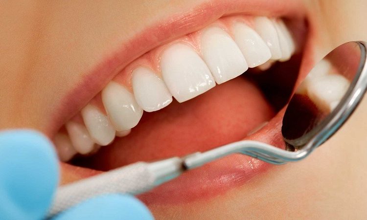طرق علاج شفافية الأسنان | أفضل جراح لثة في اصفهان