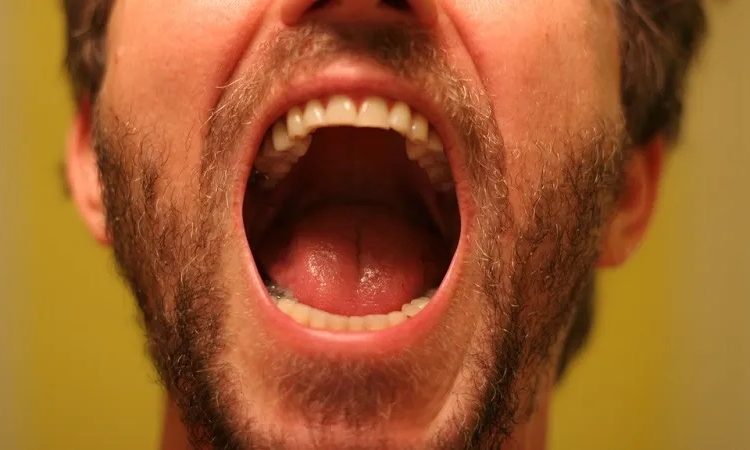 Causes and symptoms of roof of mouth pain | The best implant in Isfahan
