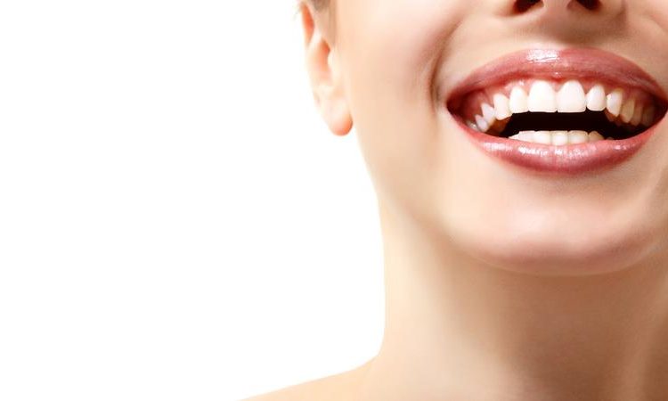 Tips on dental bonding | The best cosmetic dentist in Isfahan