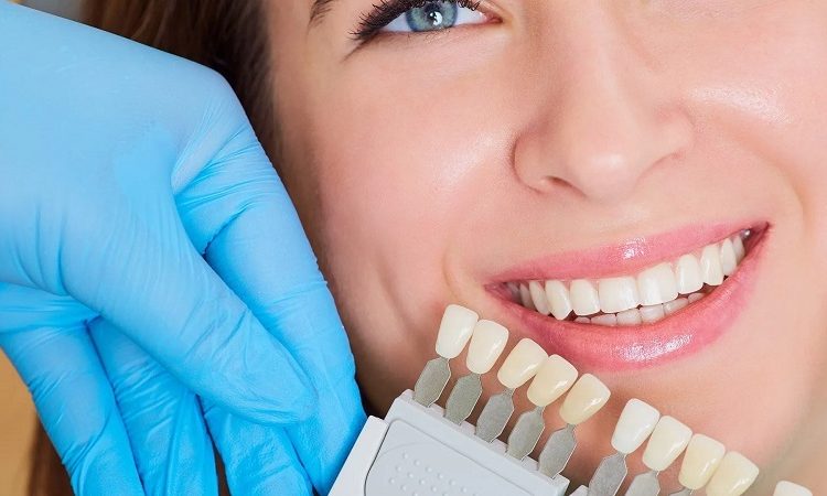 Comparison of laminate applications with dental composite | The best dentist in Isfahan