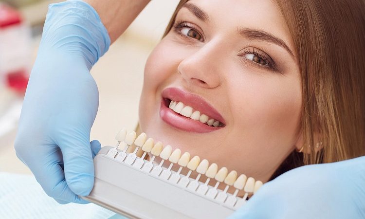 موارد نیاز به انجام لمینت دندان | Le meilleur implant à Ispahan