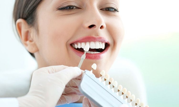 Comparaison du stratifié dentaire amovible avec Snap-on Smile | Le meilleur dentiste cosmétique à Ispahan