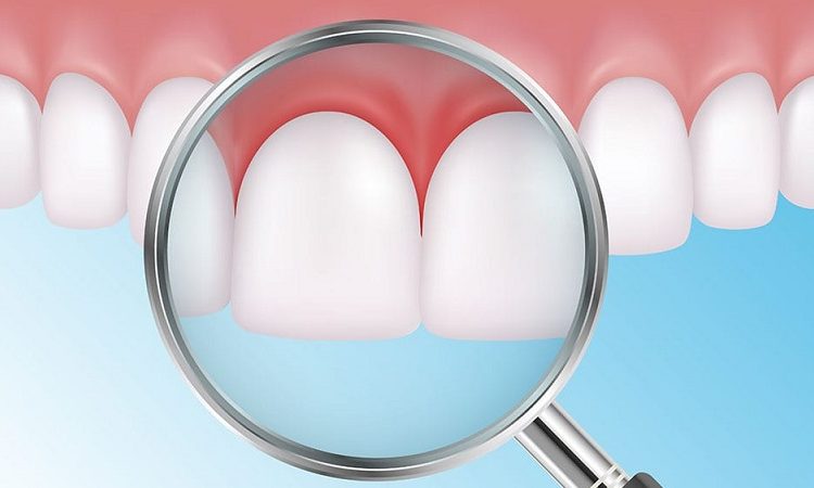 عوامل ایجاد پریودنتال | بهترین دندانپزشک اصفهان