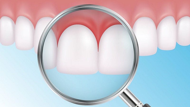 عوامل ایجاد پریودنتال | بهترین دندانپزشک اصفهان