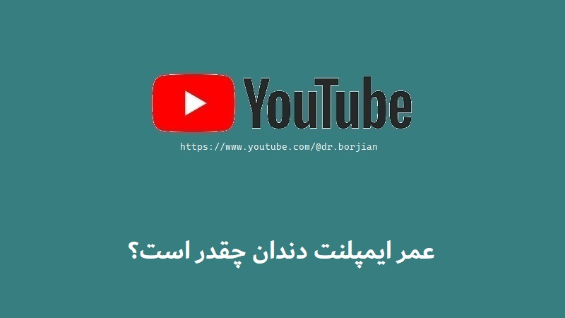 كم تدوم عملية زراعة الأسنان؟