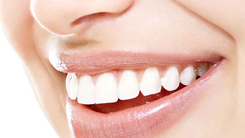 Familiarity with famous dental laminate brands | The best gum surgeon in Isfahan