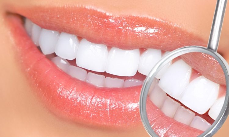 بهترین راه های درمان تغییر رنگ دندان | بهترین دندانپزشک زیبایی اصفهان