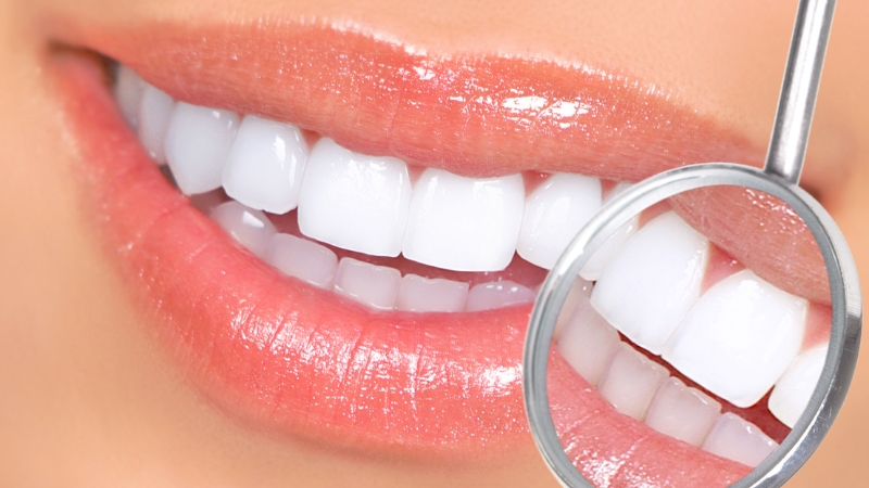 بهترین راه های درمان تغییر رنگ دندان | بهترین دندانپزشک زیبایی اصفهان