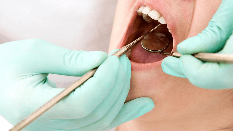 در چه مواقعی بیوپسی دهان انجام نمی گیرد؟ | Le meilleur dentiste d'Ispahan - le meilleur chirurgien des gencives d'Ispahan - le meilleur dentiste cosmétique d'Ispahan