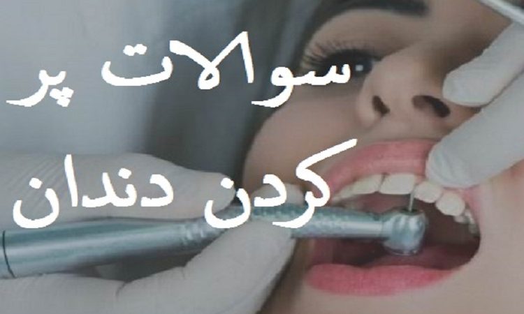 سوالات رایج پر کردن دندان ها (Part I) | The best dentist in Isfahan - the best gum surgeon in Isfahan - the best cosmetic dentist in Isfahan