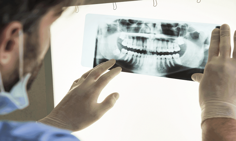 Pourquoi un scan CBCT est-il nécessaire pour les implants dentaires ? | Le meilleur dentiste d'Ispahan - le meilleur chirurgien des gencives d'Ispahan - le meilleur dentiste cosmétique d'Ispahan