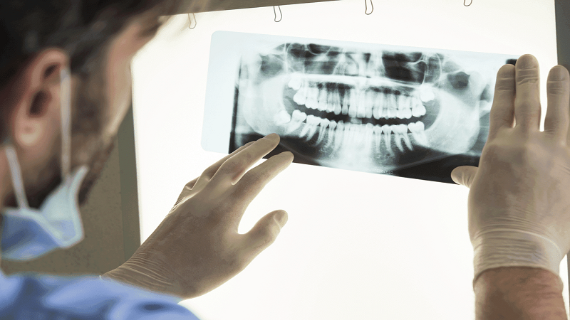 چرا اسکن CBCT برای ایمپلنت دندان ضروری است؟ | أفضل طبيب أسنان في أصفهان - أفضل جراح لثة في أصفهان - أفضل طبيب أسنان تجميلي في أصفهان