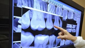 چرا اسکن CBCT برای ایمپلنت دندان ضروری است؟ | بهترین دندانپزشک اصفهان-بهترین جراح لثه اصفهان-بهترین دندانپزشک زیبایی اصفهان