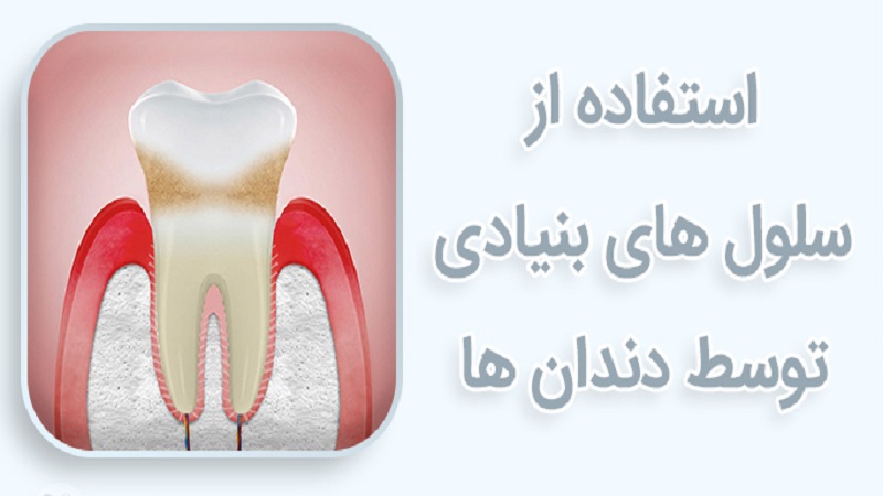 إعادة نمو الأسنان بالخلايا الجذعية | أفضل طبيب أسنان في أصفهان - أفضل جراح لثة في أصفهان - أفضل طبيب أسنان تجميلي في أصفهان
