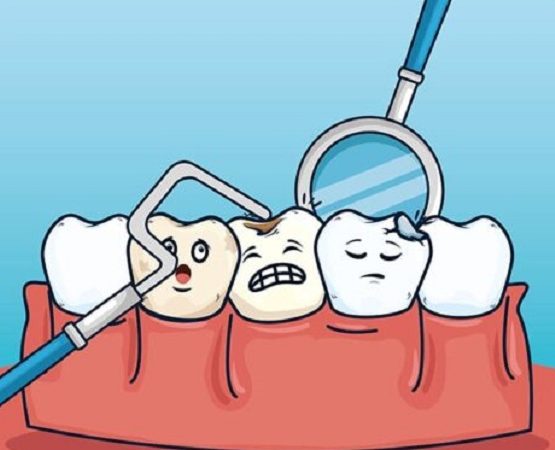 متى يجب استبدال حشوات الأسنان؟ | أفضل طبيب أسنان في أصفهان - أفضل جراح لثة في أصفهان - أفضل طبيب أسنان تجميلي في أصفهان