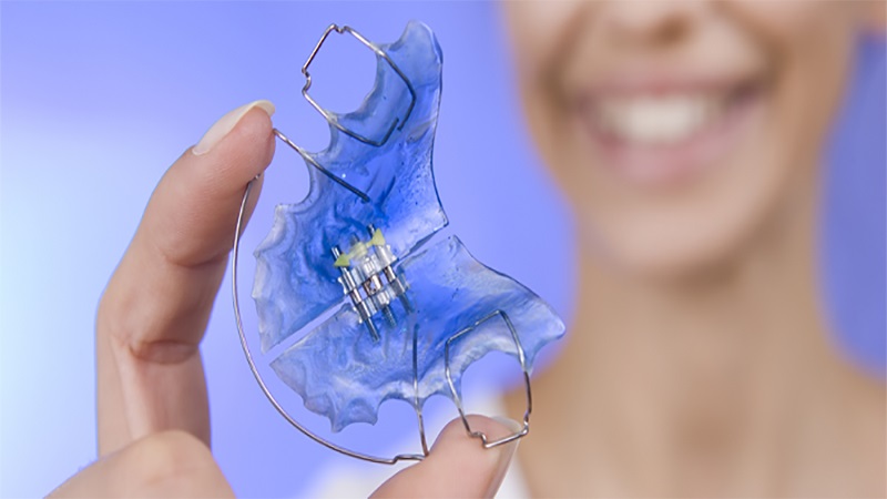 What is a palate expander? | The best dentist in Isfahan - the best gum surgeon in Isfahan - the best cosmetic dentist in Isfahan