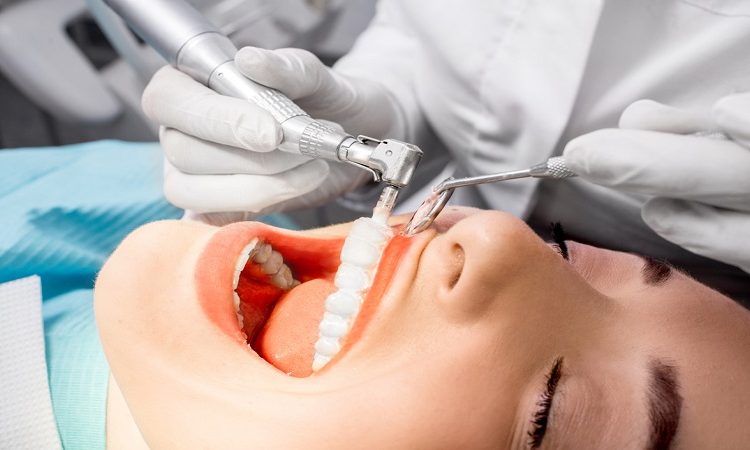 جرمگیری و بروساژ دندان | Le meilleur dentiste d'Ispahan - le meilleur chirurgien des gencives d'Ispahan - le meilleur dentiste cosmétique d'Ispahan | Dr Hossein Borjian