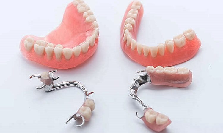Types of dental prostheses | The best dentist in Isfahan - the best gum surgeon in Isfahan - the best cosmetic dentist in Isfahan | Dr. Hossein Borjian