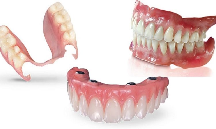 أفضل طبيب أسنان في أصفهان - أفضل جراح لثة في أصفهان - أفضل طبيب أسنان تجميلي في أصفهان | د. حسين بورجيان