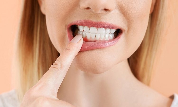 مراقبتهای قبل از جراحی لثه | بهترین دندانپزشک اصفهان-بهترین جراح لثه اصفهان-بهترین دندانپزشک زیبایی اصفهان | دکتر حسین برجیان