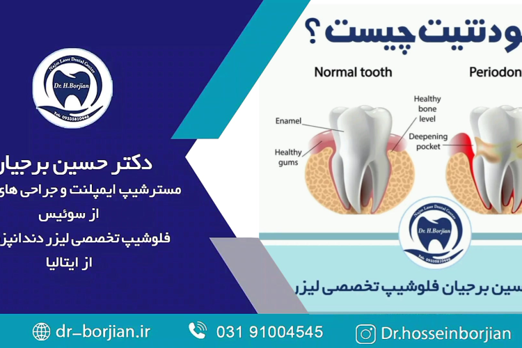 بهترین دندانپزشک اصفهان-بهترین جراح لثه اصفهان-قیمت ایمپلنت دندان اصفهان| دکتر حسین برجیان