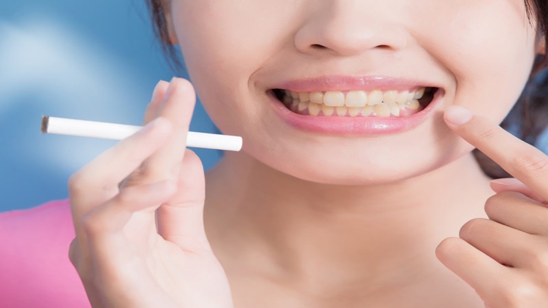 L'effet des cigarettes sur la santé bucco-dentaire | Le meilleur dentiste à Ispahan - le meilleur chirurgien des gencives à Ispahan - le prix des implants dentaires à Ispahan| Dr Hossein Borjian