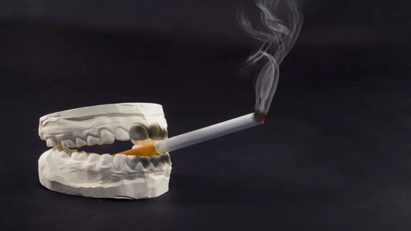 L'effet des cigarettes sur la santé bucco-dentaire | Le meilleur dentiste à Ispahan - le meilleur chirurgien des gencives à Ispahan - le prix des implants dentaires à Ispahan| Dr Hossein Borjian