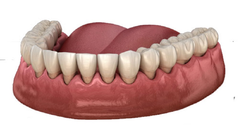 Gum transplant for older patients | The best dentist in Isfahan - the best gum surgeon in Isfahan - the price of dental implants in Isfahan| Dr. Hossein Borjian