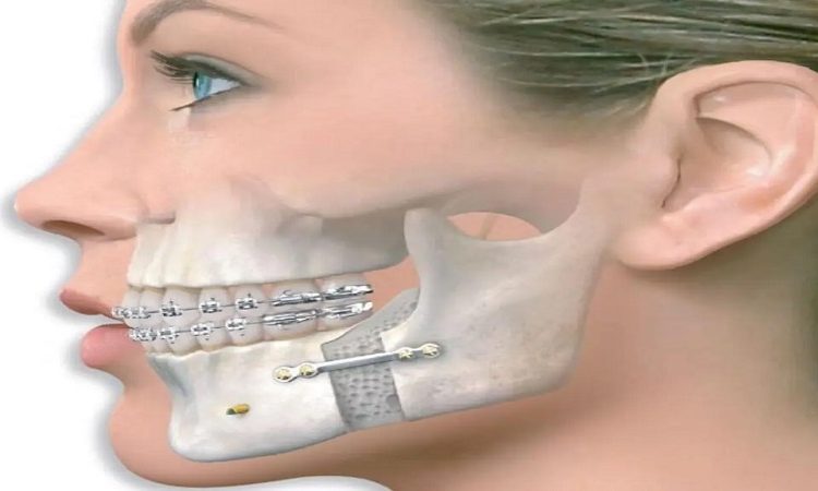 تکنیک‌های جدید در جراحی فک و صورت | بهترین دندانپزشک اصفهان-بهترین جراح لثه اصفهان-قیمت ایمپلنت دندان اصفهان| دکتر حسین برجیان