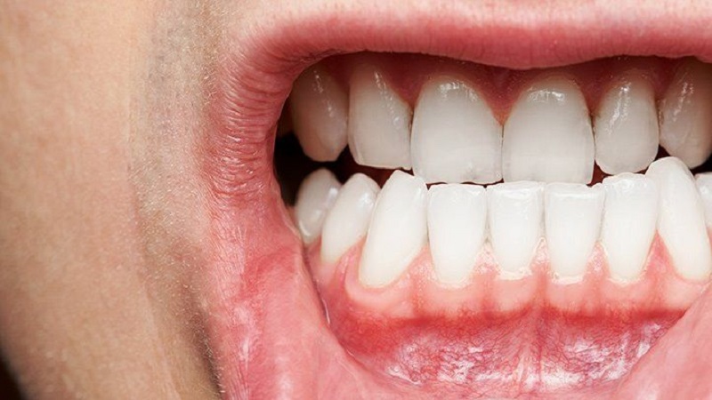 Liens utiles:

بهترین دندانپزشک اصفهان _ بهترین جراح لثه اصفهان

راه های ارتباطی با مرکز تخصصی دندانپزشکی نجم

بهترین دندانپزشک اصفهان در کلینیک 24 _ درمان بیماری های دهان، فک و صورت در کلینیک 24 _ بیماری لثه در کلینیک 24

Voir la page Instagram officielle du Dr Hossein Borjian.

بهترین دندانپزشک اصفهان در دکتر آف _ بهترین جراح لثه اصفهان در دکتر آف _ بهترین دندانپزشک زیبایی اصفهان در دکتر آف