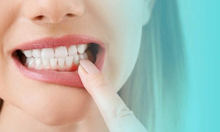 جماليات | أفضل طبيب أسنان في أصفهان - أفضل جراح لثة في أصفهان - سعر زراعة الأسنان في أصفهان| د. حسين بورجيان