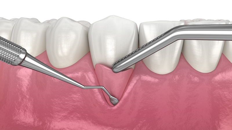 دندانپزشکی دیجیتال | The best dentist in Isfahan - the best gum surgeon in Isfahan - the price of dental implants in Isfahan| Dr. Hossein Borjian