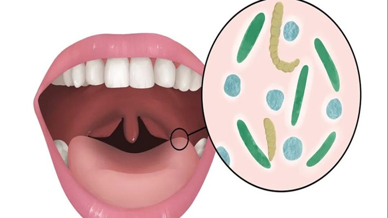 تأثیر پروبیوتیک‌ها بر بیماری‌های دهانی | The best dentist in Isfahan - the best gum surgeon in Isfahan - the price of dental implants in Isfahan| Dr. Hossein Borjian