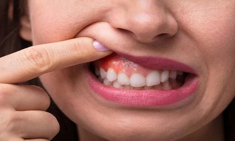 New methods of treating gum disease | Dr. Hossein Borjian (The best dentist in Isfahan - the best gum surgeon in Isfahan - the best cosmetic dentist in Isfahan)