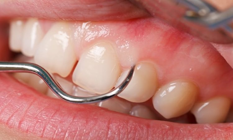 The best dentist in Isfahan - the best gum surgeon in Isfahan - the price of dental implants in Isfahan| Dr. Hossein Borjian