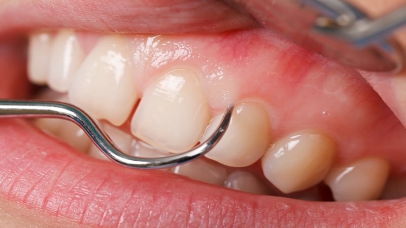 Le meilleur dentiste à Ispahan - le meilleur chirurgien des gencives à Ispahan - le prix des implants dentaires à Ispahan| Dr Hossein Borjian