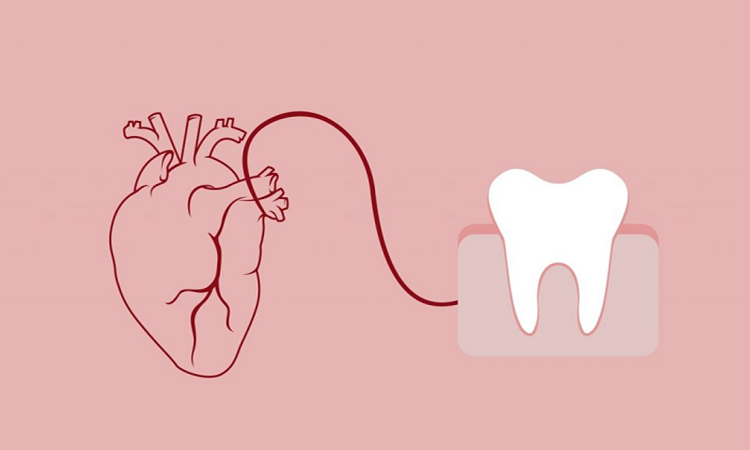 The relationship between gum disease and heart disease | The best dentist in Isfahan - the best gum surgeon in Isfahan - the price of dental implants in Isfahan| Dr. Hossein Borjian