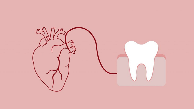 رابطه بین بیماری‌های لثه و بیماری‌های قلبی | Le meilleur dentiste à Ispahan - le meilleur chirurgien des gencives à Ispahan - le prix des implants dentaires à Ispahan| Dr Hossein Borjian