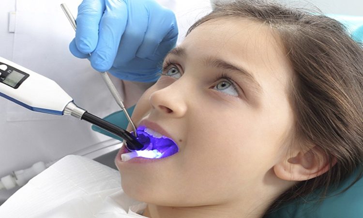 تأثیر دما و زمان بر اثربخشی بلیچینگ با لیزر | بهترین دندانپزشک اصفهان-بهترین جراح لثه اصفهان-قیمت ایمپلنت دندان اصفهان| دکتر حسین برجیان