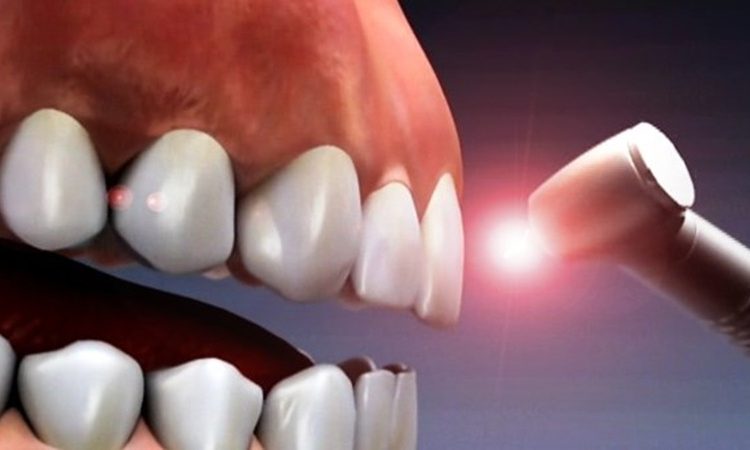 بهترین دندانپزشک اصفهان-بهترین جراح لثه اصفهان-قیمت ایمپلنت دندان اصفهان| دکتر حسین برجیان