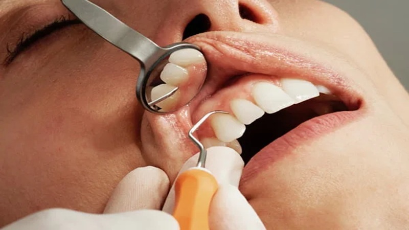 تأثیر مشکلات لثه بر موفقیت ایمپلنت دندانی | بهترین دندانپزشک اصفهان-بهترین جراح لثه اصفهان-قیمت ایمپلنت دندان اصفهان| دکتر حسین برجیان