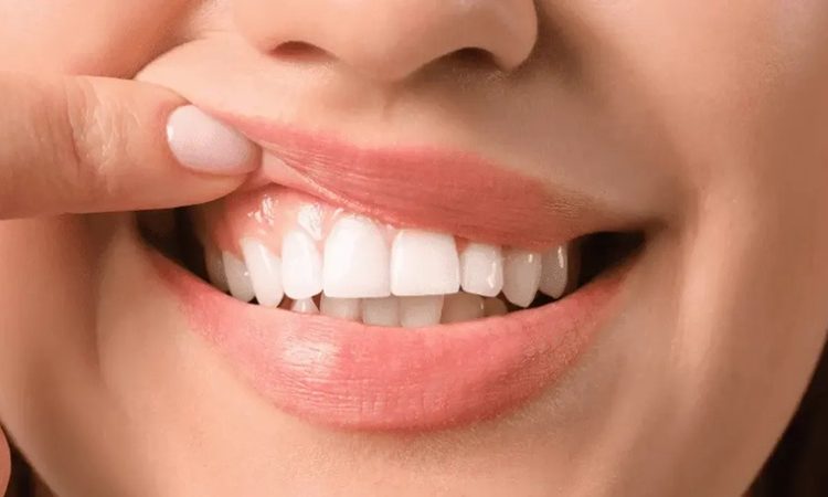 درمان التهاب لثه | Dr. Hossein Borjian (The best dentist in Isfahan - the best gum surgeon in Isfahan - the best cosmetic dentist in Isfahan)