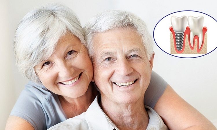 تأثیر سن بر موفقیت ایمپلنت دندانی | بهترین دندانپزشک اصفهان-بهترین جراح لثه اصفهان-قیمت ایمپلنت دندان اصفهان| دکتر حسین برجیان