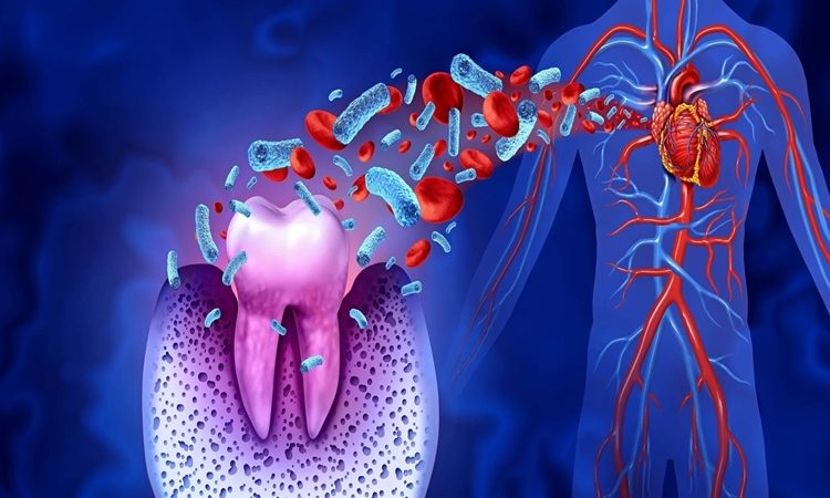 رابطه بین بیماری‌های لثه و بیماری‌های قلبی | بهترین دندانپزشک اصفهان-بهترین جراح لثه اصفهان-قیمت ایمپلنت دندان اصفهان| دکتر حسین برجیان
