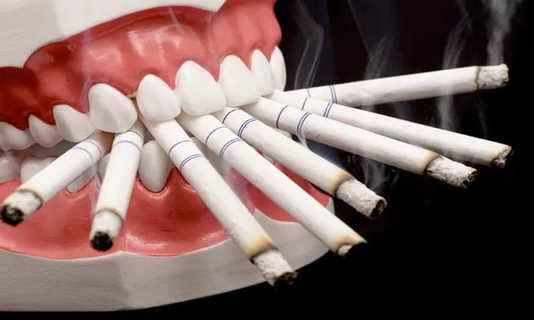 تأثیر سیگار بر نتایج جراحی لثه و پیوند استخوان | بهترین دندانپزشک اصفهان-بهترین جراح لثه اصفهان-قیمت ایمپلنت دندان اصفهان| دکتر حسین برجیان