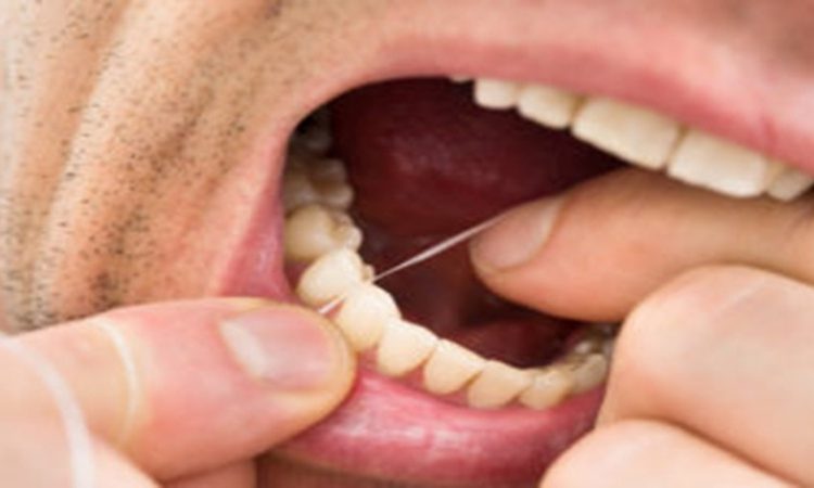 چرا هنگام نخ دندان کشیدن لثه‌ام خونریزی می‌کند؟ | دکتر حسین برجیان (بهترین دندانپزشک اصفهان-بهترین جراح لثه اصفهان-بهترین دندانپزشک زیبایی اصفهان)