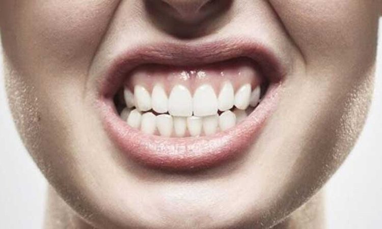 چطور می‌توان از ساییدن دندان (براکسیسم) جلوگیری یا آن را درمان کرد؟ | دکتر حسین برجیان (بهترین دندانپزشک اصفهان-بهترین جراح لثه اصفهان-بهترین دندانپزشک زیبایی اصفهان)