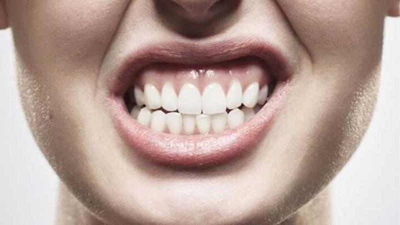 چطور می‌توان از ساییدن دندان (براکسیسم) جلوگیری یا آن را درمان کرد؟ | دکتر حسین برجیان (بهترین دندانپزشک اصفهان-بهترین جراح لثه اصفهان-بهترین دندانپزشک زیبایی اصفهان)